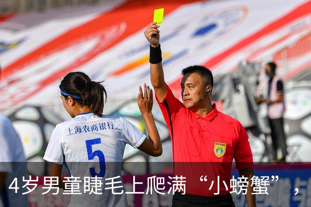 4岁男童睫毛上爬满“小螃蟹”，原是阴虱感染